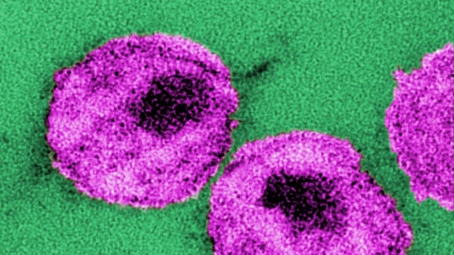 HIV Particles.JPG